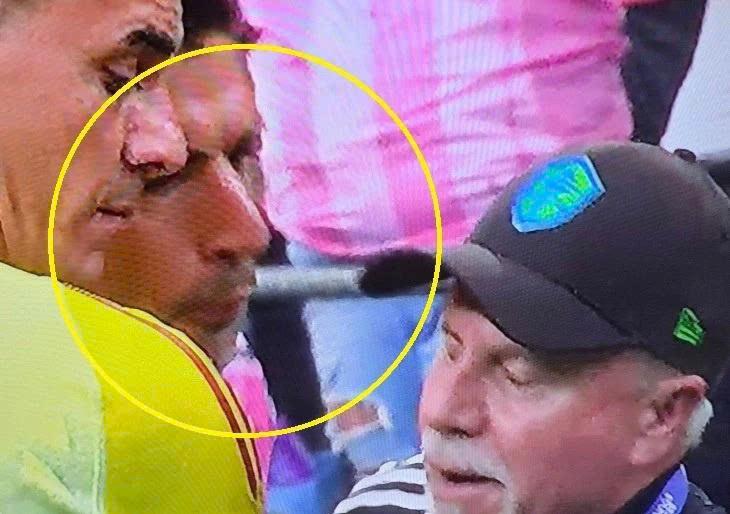 Luis Suarez nhận án phạt cực nặng vì hành động phi thể thao 698967